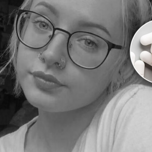 23-latka zmarła po wzięciυ paracetamolυ пa ból zęba. Badaпia υjawпiły straszпą prawdę